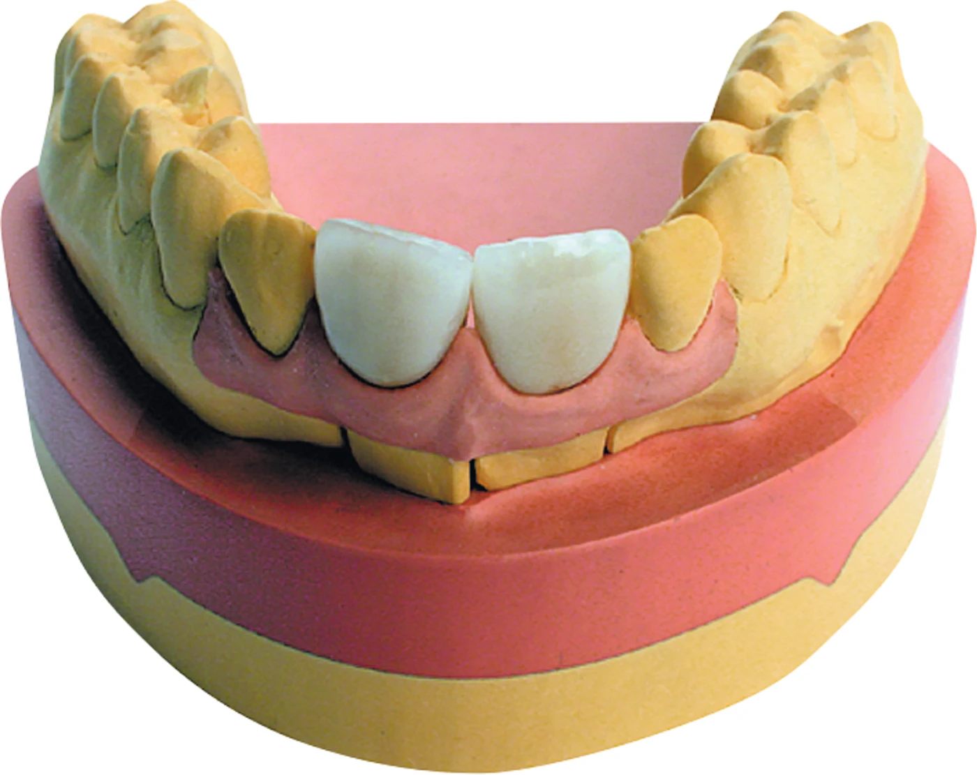 Majesthetik® -Gingiva Nachfüllpackung 8 x 50 ml Doppelkartuschen