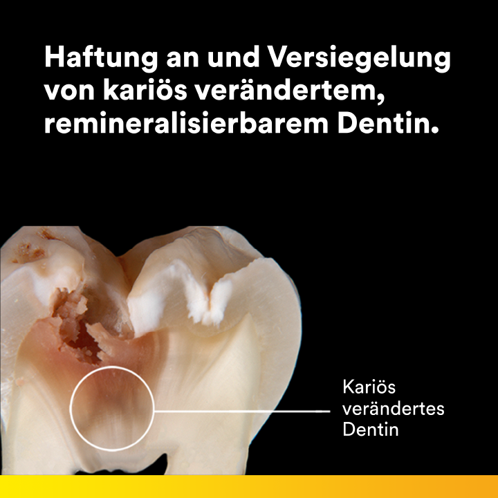 Scotchbond™ Universal Plus Adhäsiv Flasche 5 ml, Gebrauchsanweisung Scotchbond™ Universal Plus Adhäsiv Flasche 5 ml, Gebrauchsanweisung