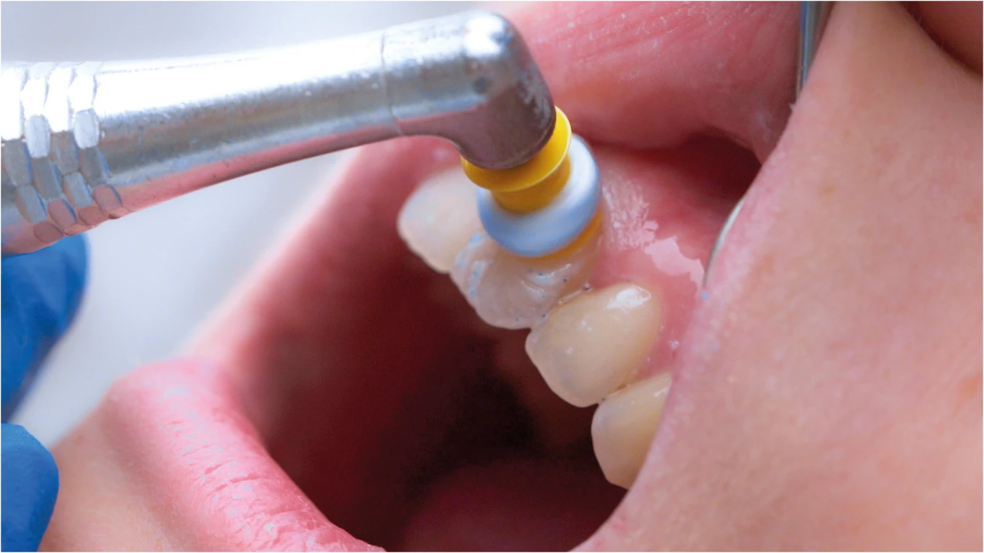 ProphyCare® Prophy Paste HAp Tube 60 g