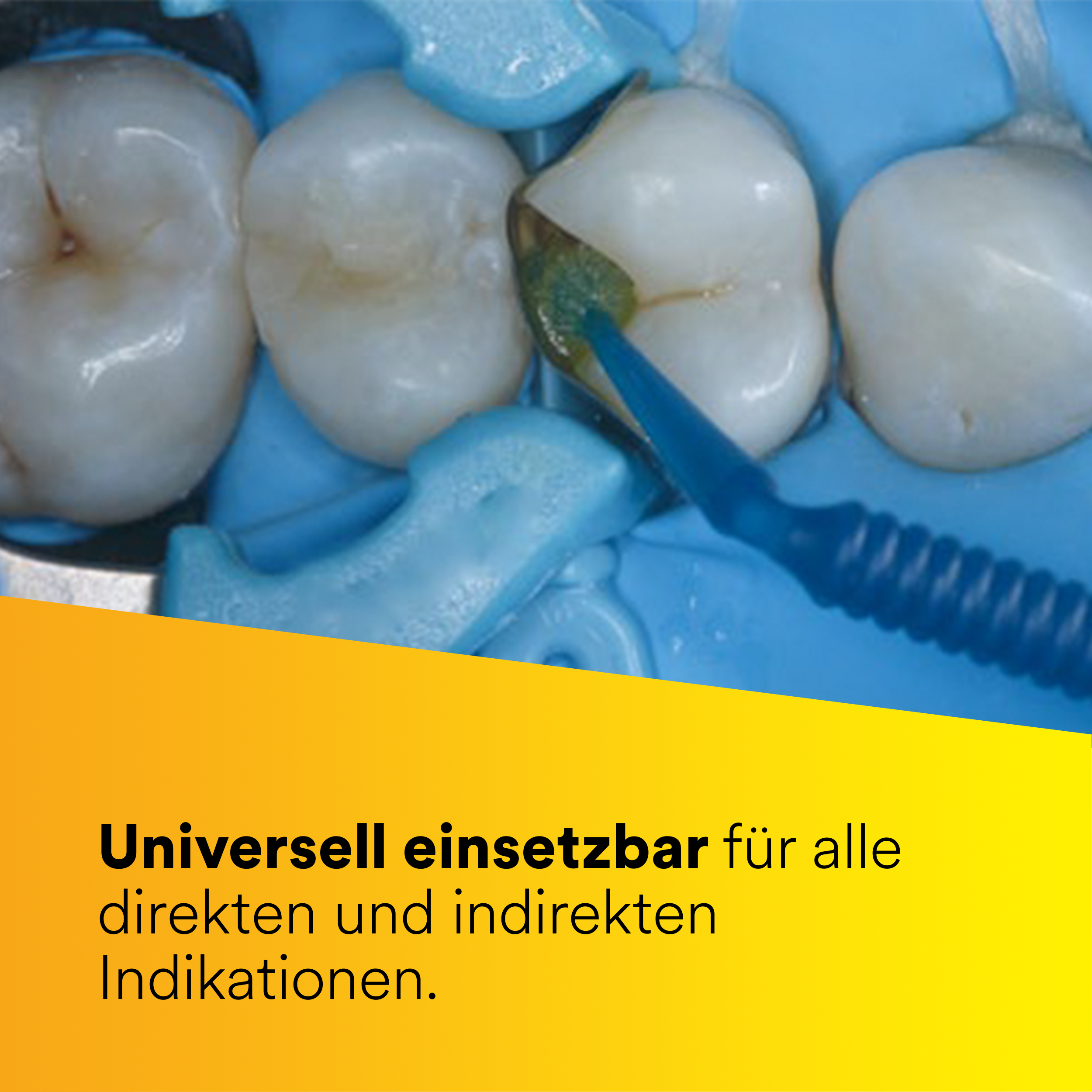 Scotchbond™ Universal Plus Adhäsiv Flasche 5 ml, Gebrauchsanweisung Scotchbond™ Universal Plus Adhäsiv Flasche 5 ml, Gebrauchsanweisung