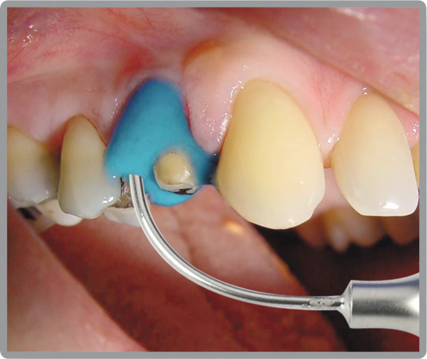 ALGILOID® Packung 48 Zylinderampullen ALGILOID® Packung 48 Zylinderampullen