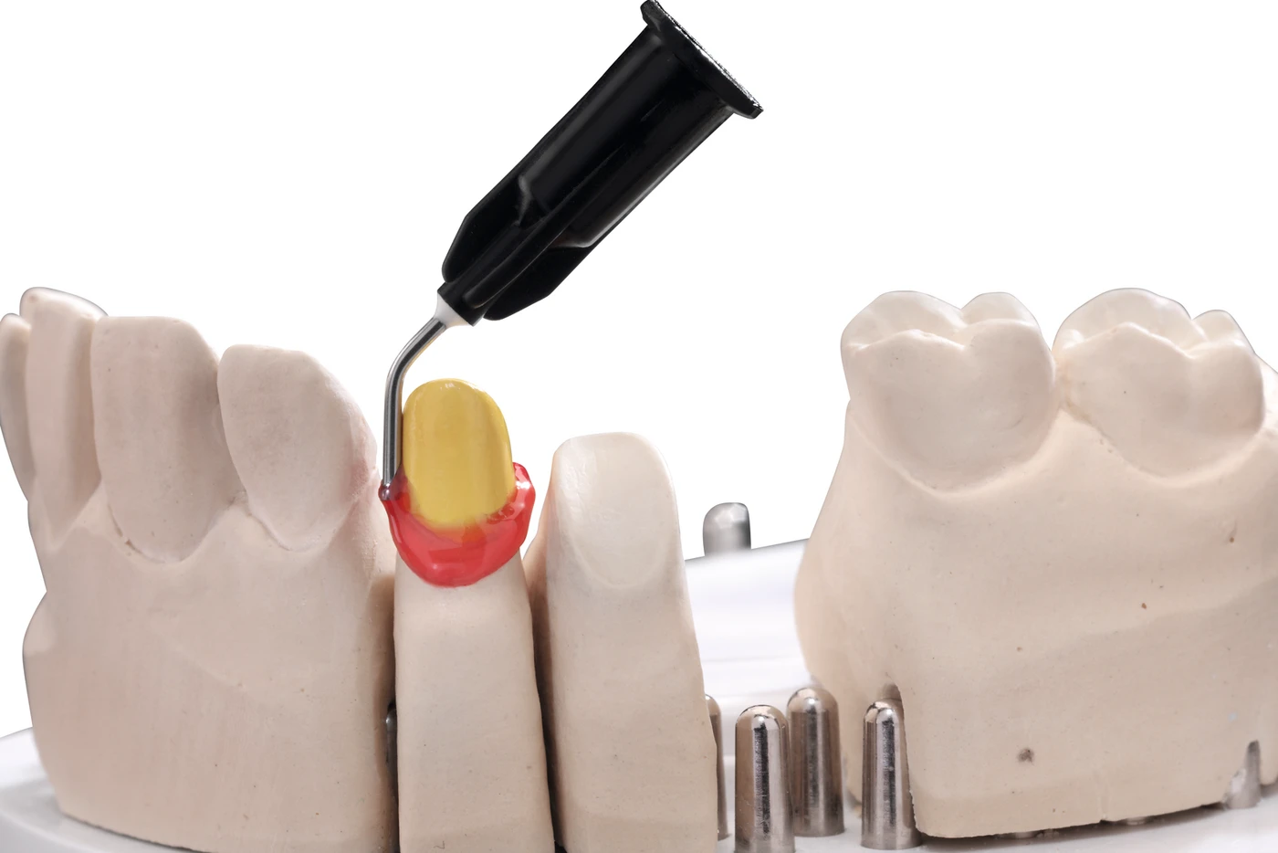 easyform LC Standardpackung 3 x 3 g Spritze Gel