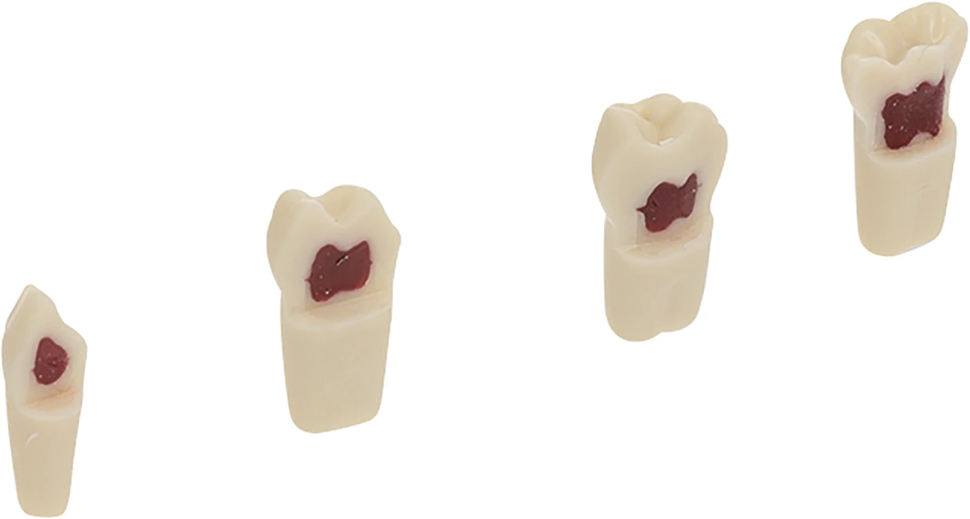 Kindermodellzähne AK-6/2 Stück mit Wachs gefüllt, Nr. 85