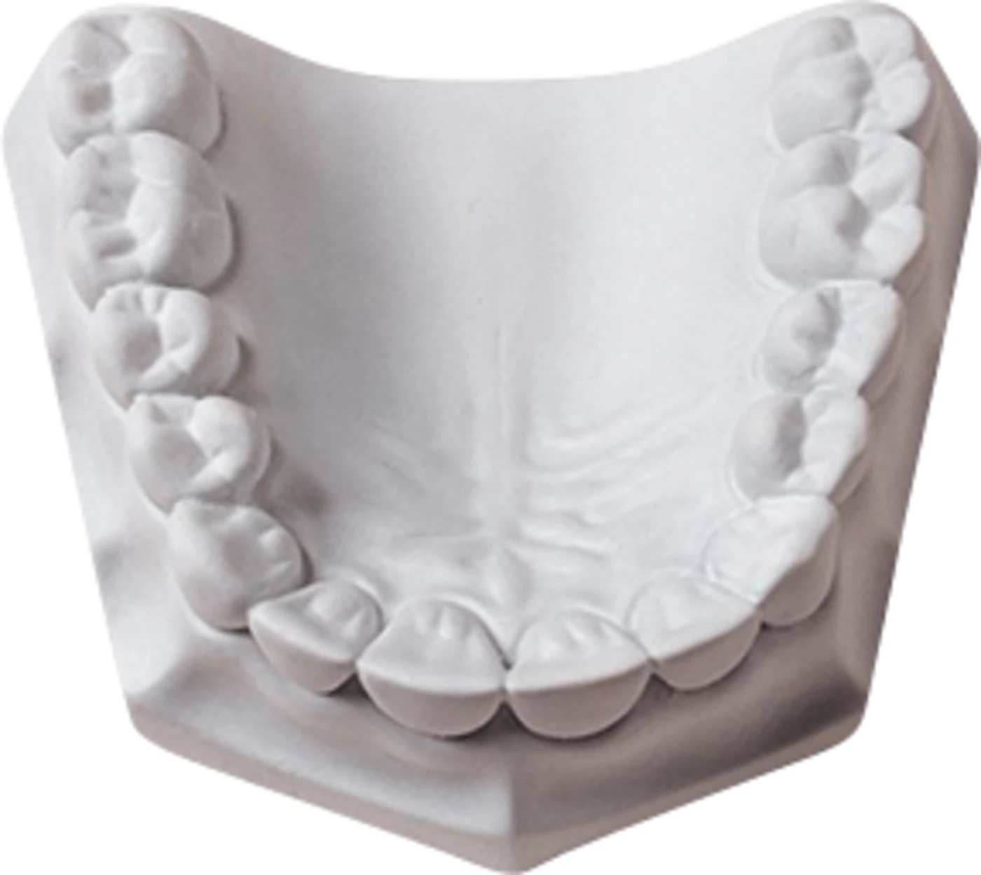 Silky-Rock Karton 15 kg Superhartgips white