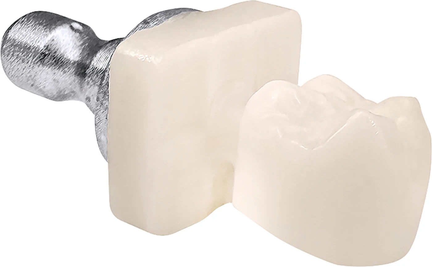 VISALYS® BIOCERAMIC BLOCK Packung 5 Stück Chroma, A0