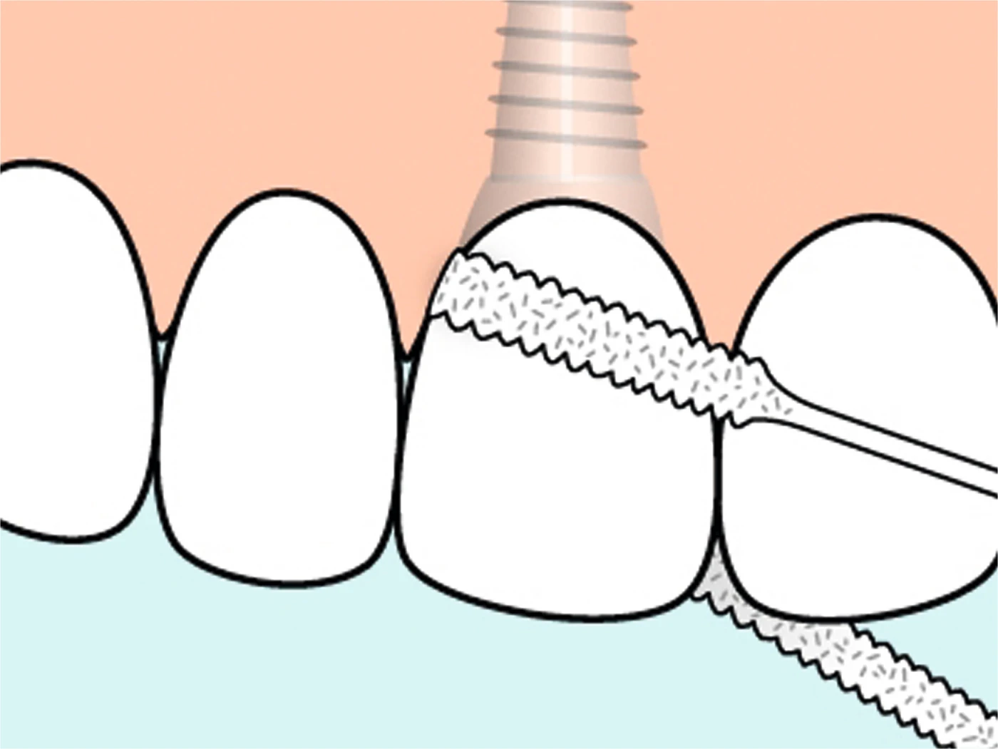 TePe® Bridge & Implant Floss Box 30 Stück