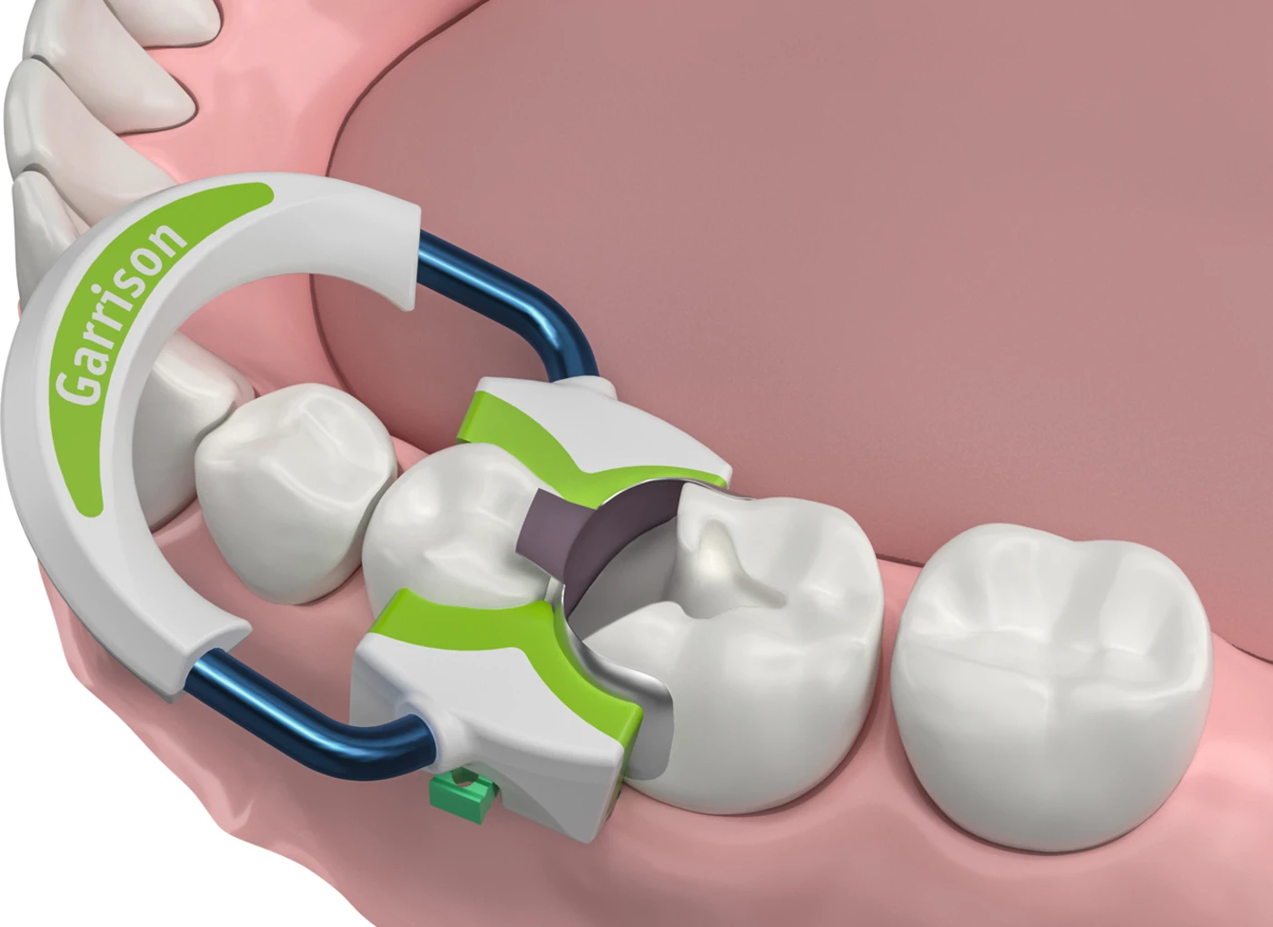 Strata-G™ Teilmatrizen-Ringe Stück Stück breit, grün Strata-G™ Teilmatrizen-Ringe Stück Stück breit, grün