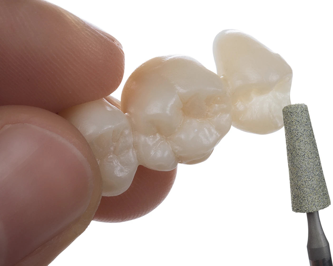 Omni Diamantschleifer MCP Stück gelb grob, HP, Konus, Kopflänge: 11 mm, Ø 4 mm Omni Diamantschleifer MCP Stück gelb grob, HP, Konus, Kopflänge: 11 mm, Ø 4 mm