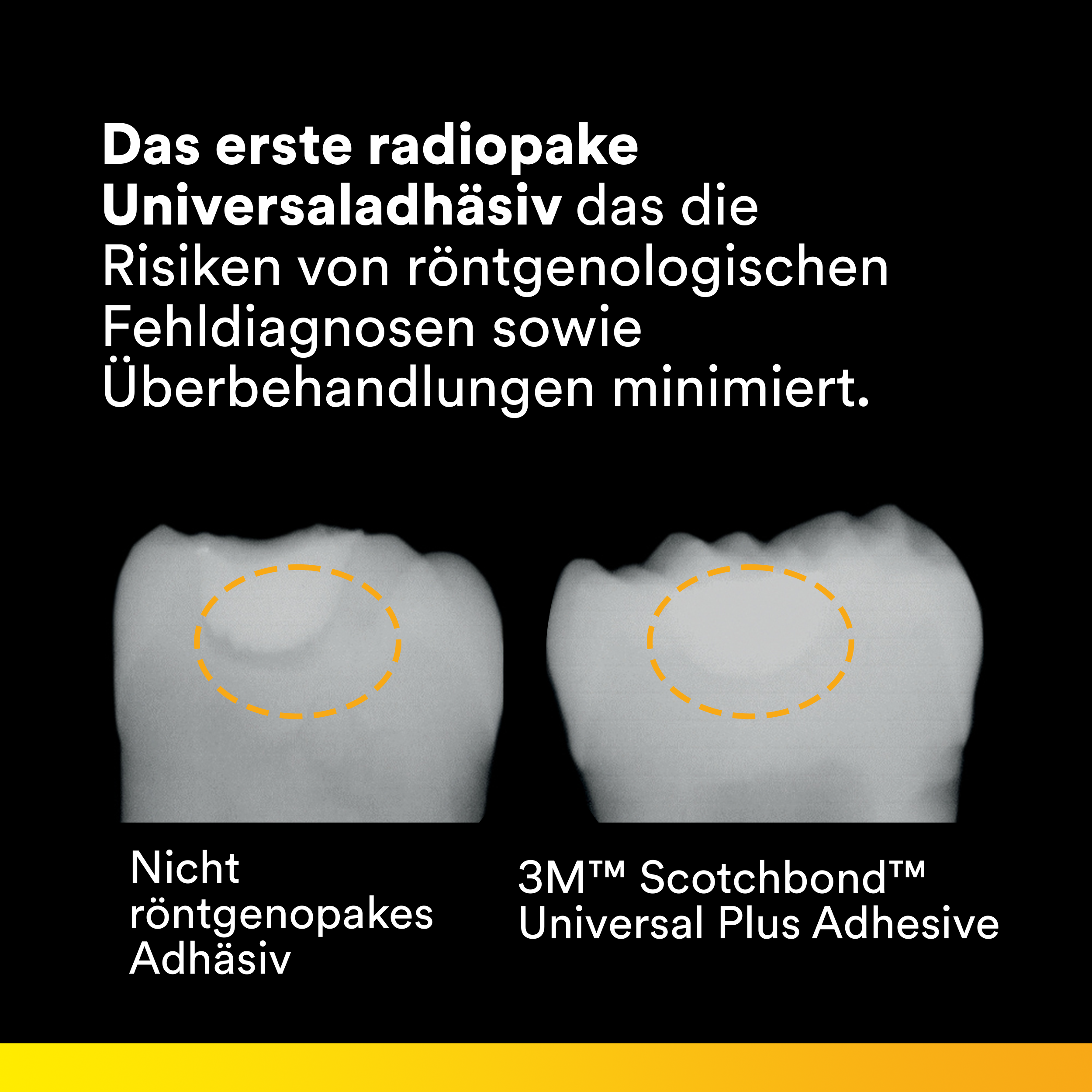 Scotchbond™ Universal Plus Adhäsiv Flasche 5 ml, Gebrauchsanweisung Scotchbond™ Universal Plus Adhäsiv Flasche 5 ml, Gebrauchsanweisung