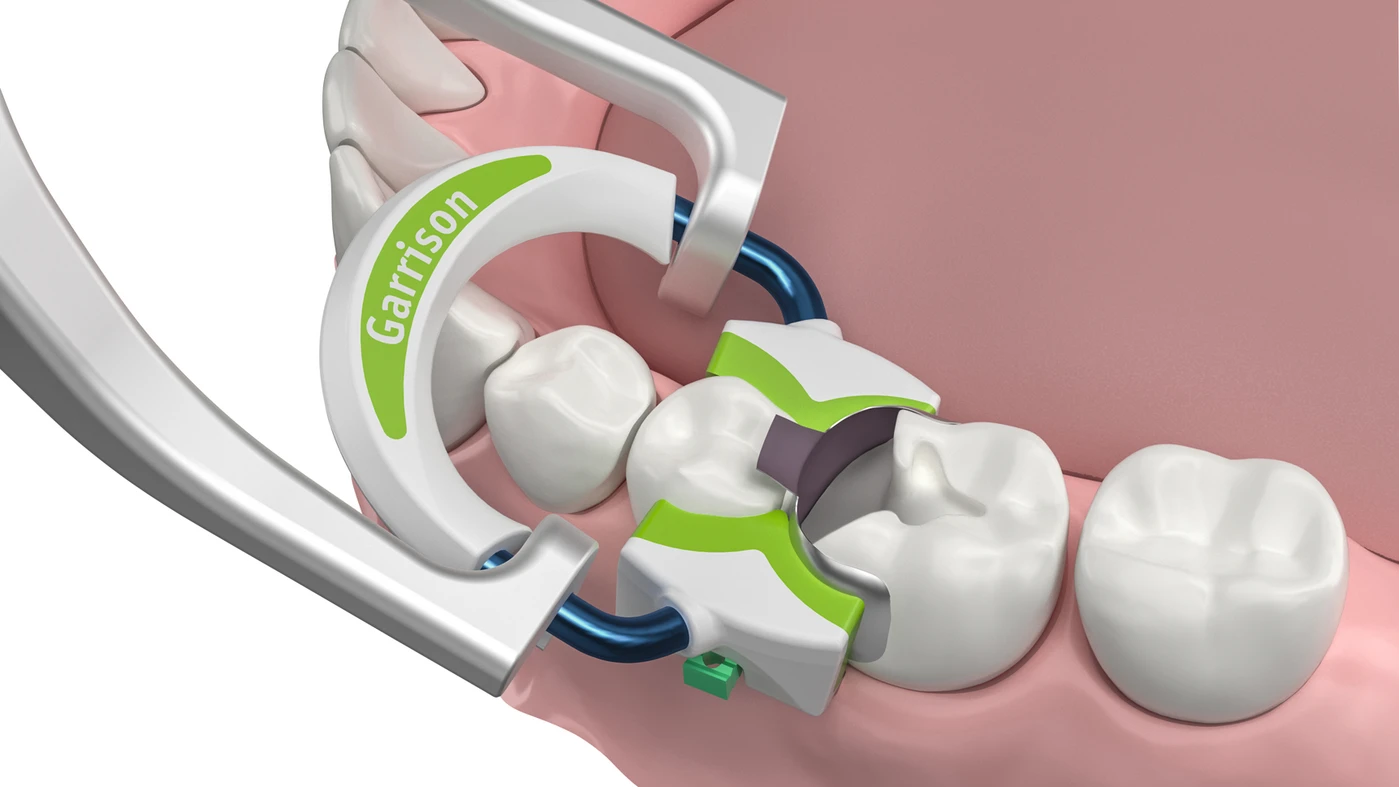 Strata-G™ Teilmatrizen-Ringe Stück Stück breit, grün Strata-G™ Teilmatrizen-Ringe Stück Stück breit, grün