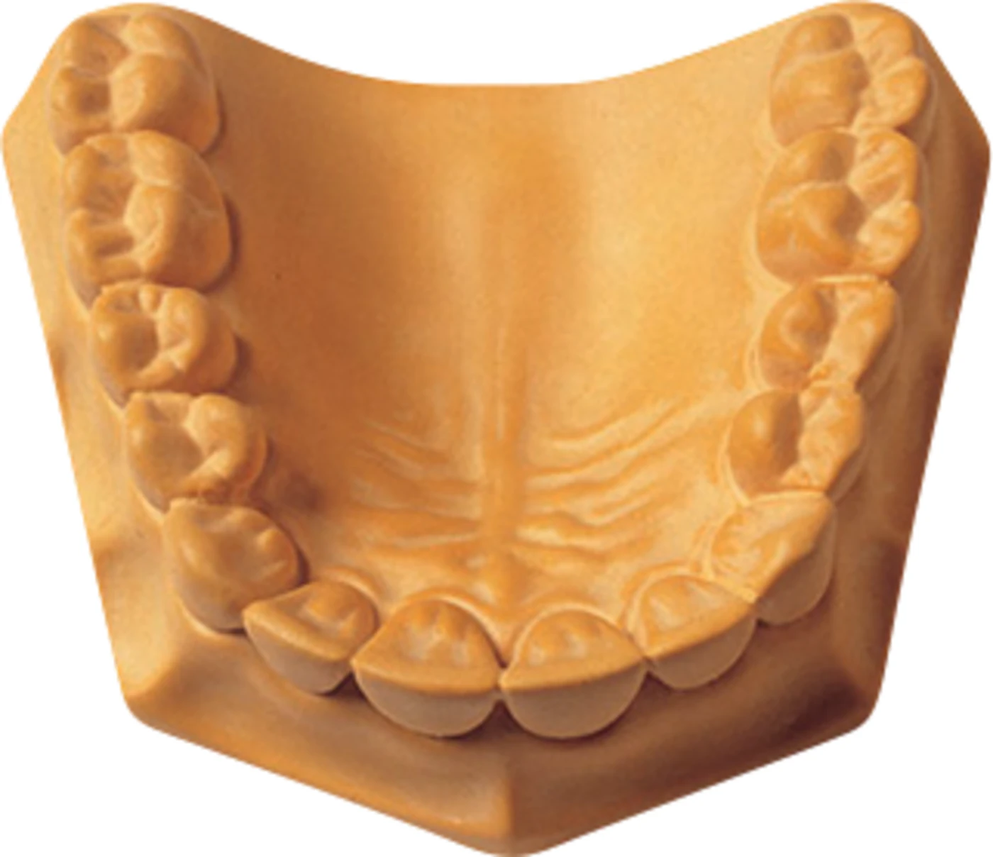 Prima-Rock Karton 15 kg Superhartgips yellow Prima-Rock Karton 15 kg Superhartgips yellow