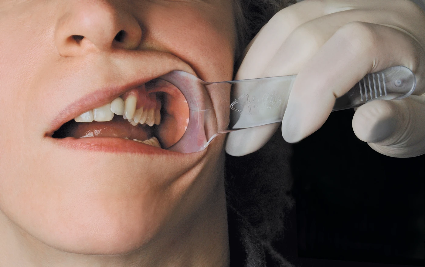 Mirahold® Wangenhalter Packung 2 Stück Bambino