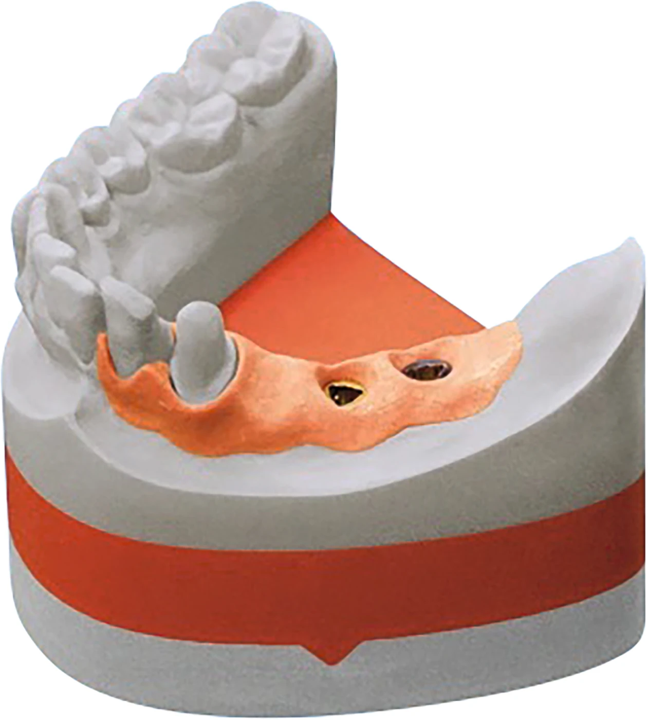 Implantat-rock® Karton 20 kg grau