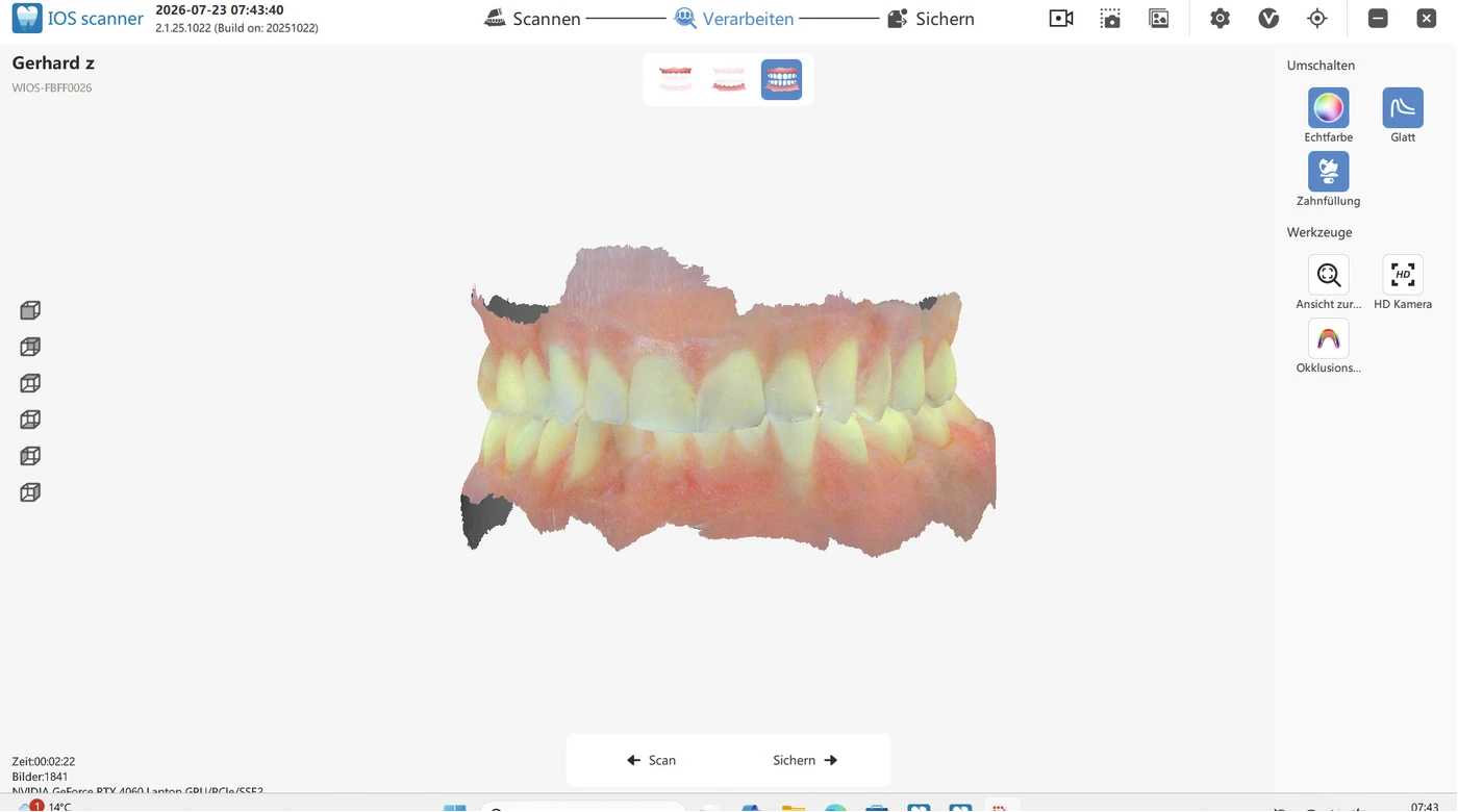 DX Mobile Koffer Intraoralscanner inklusive Zubehör