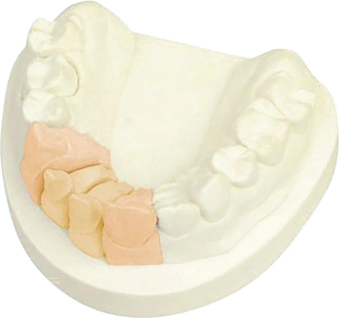 picopoly® Set apricot