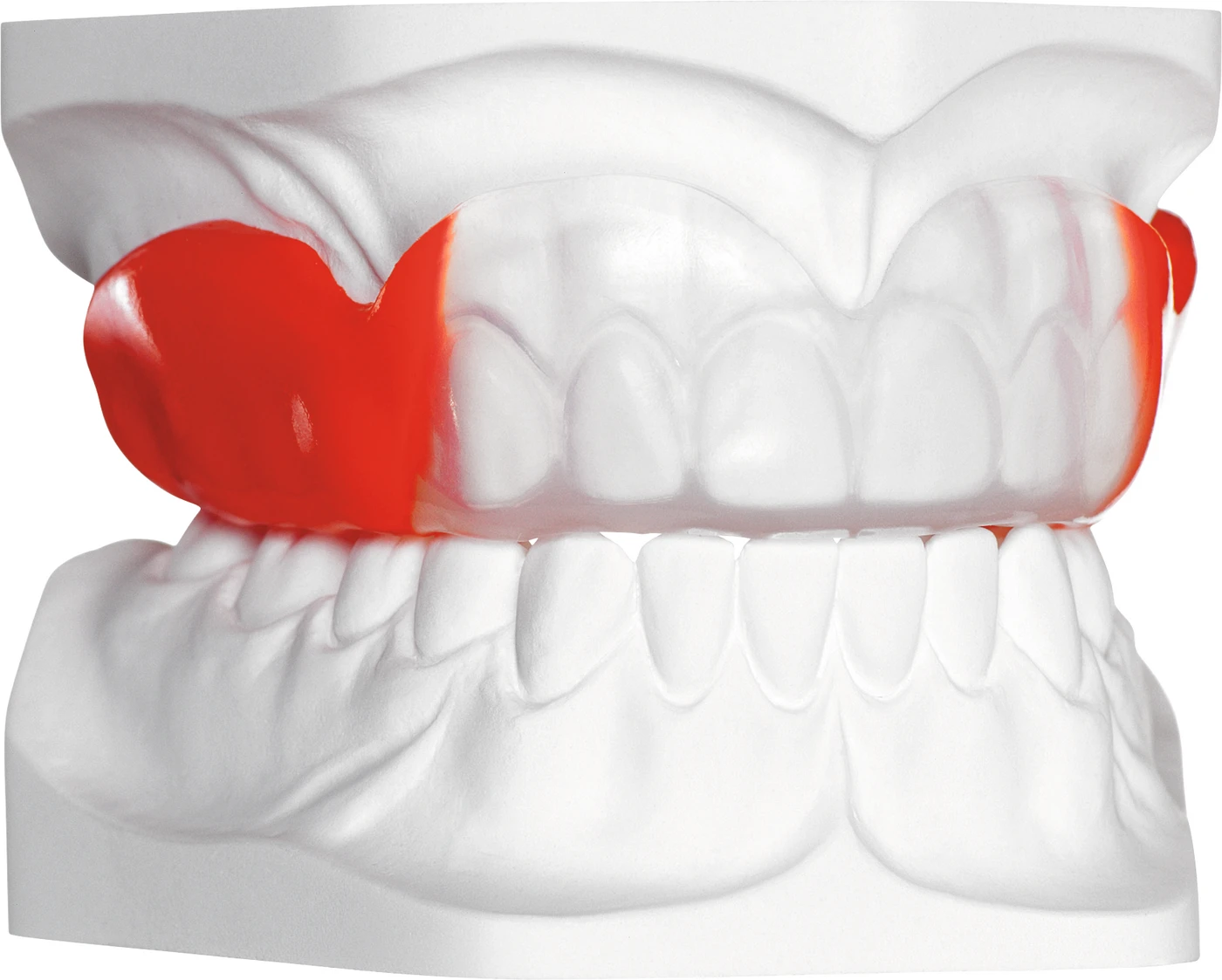 BIOPLAST® XTREME Kit 5 mm BIOPLAST XTREME-Folie rot, Zubehör BIOPLAST® XTREME Kit 5 mm BIOPLAST XTREME-Folie rot, Zubehör