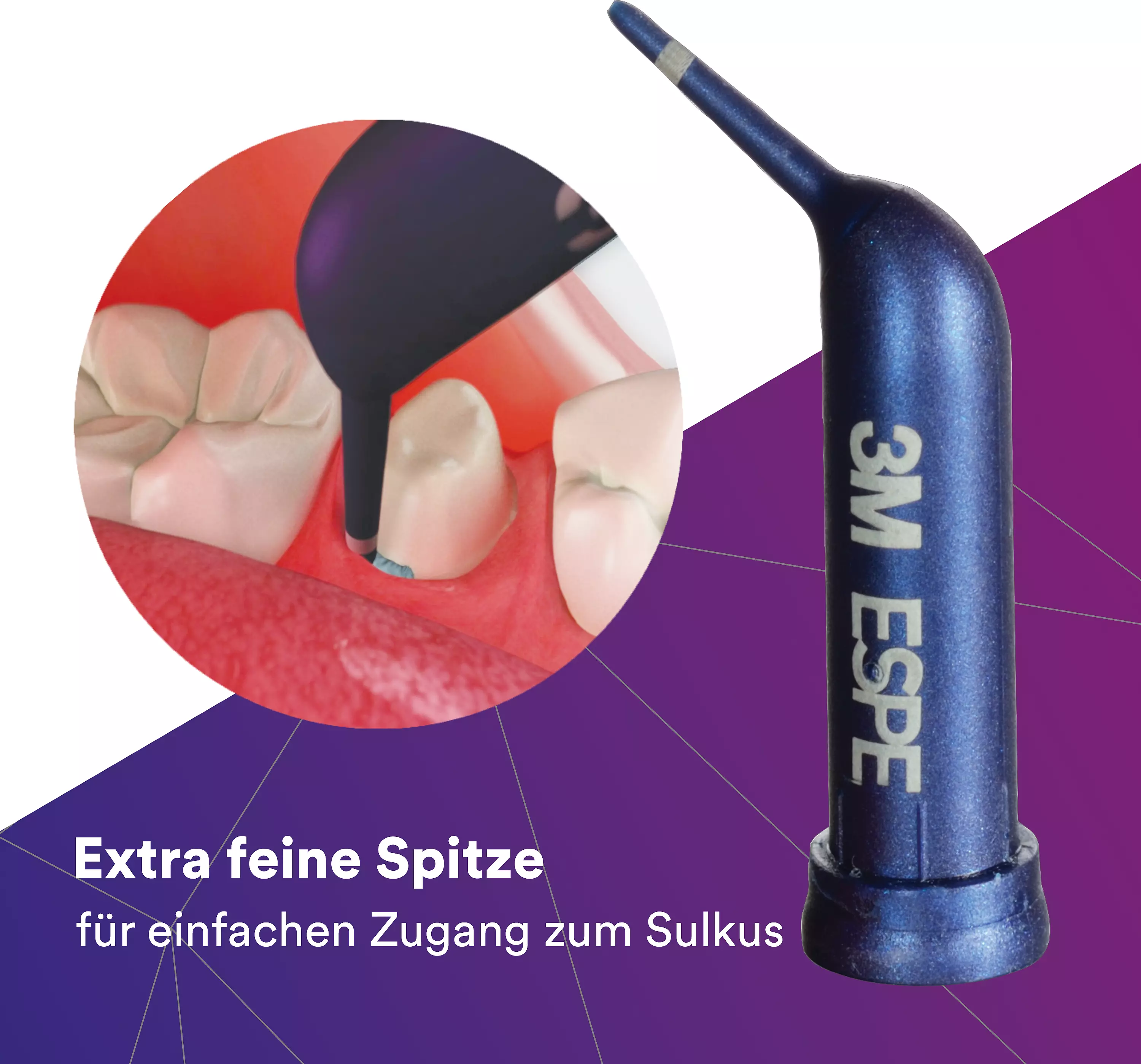 Adstringierende Retraktionspaste Refill Packung 25 Kapseln, 1 Gebrauchsanweisung Adstringierende Retraktionspaste Refill Packung 25 Kapseln, 1 Gebrauchsanweisung