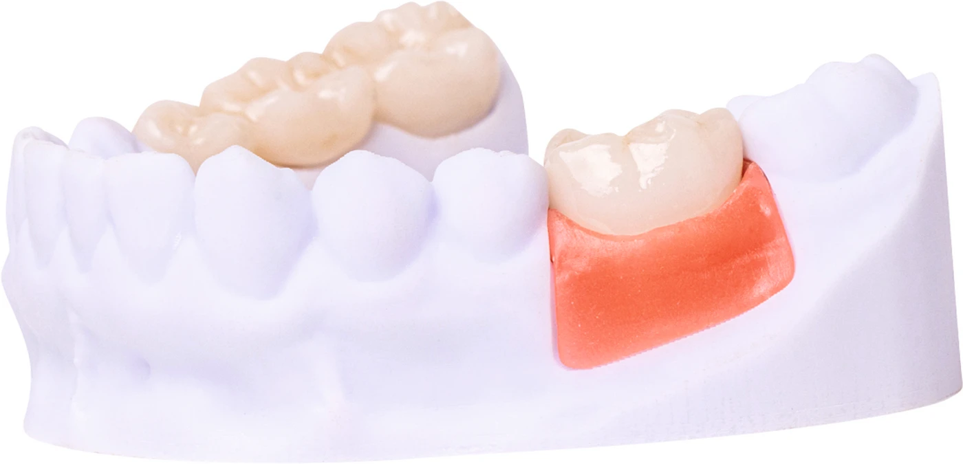 FREEPRINT® gingiva Flasche 1 kg Kunststoff 385 nm, gingiva FREEPRINT® gingiva Flasche 1 kg Kunststoff 385 nm, gingiva