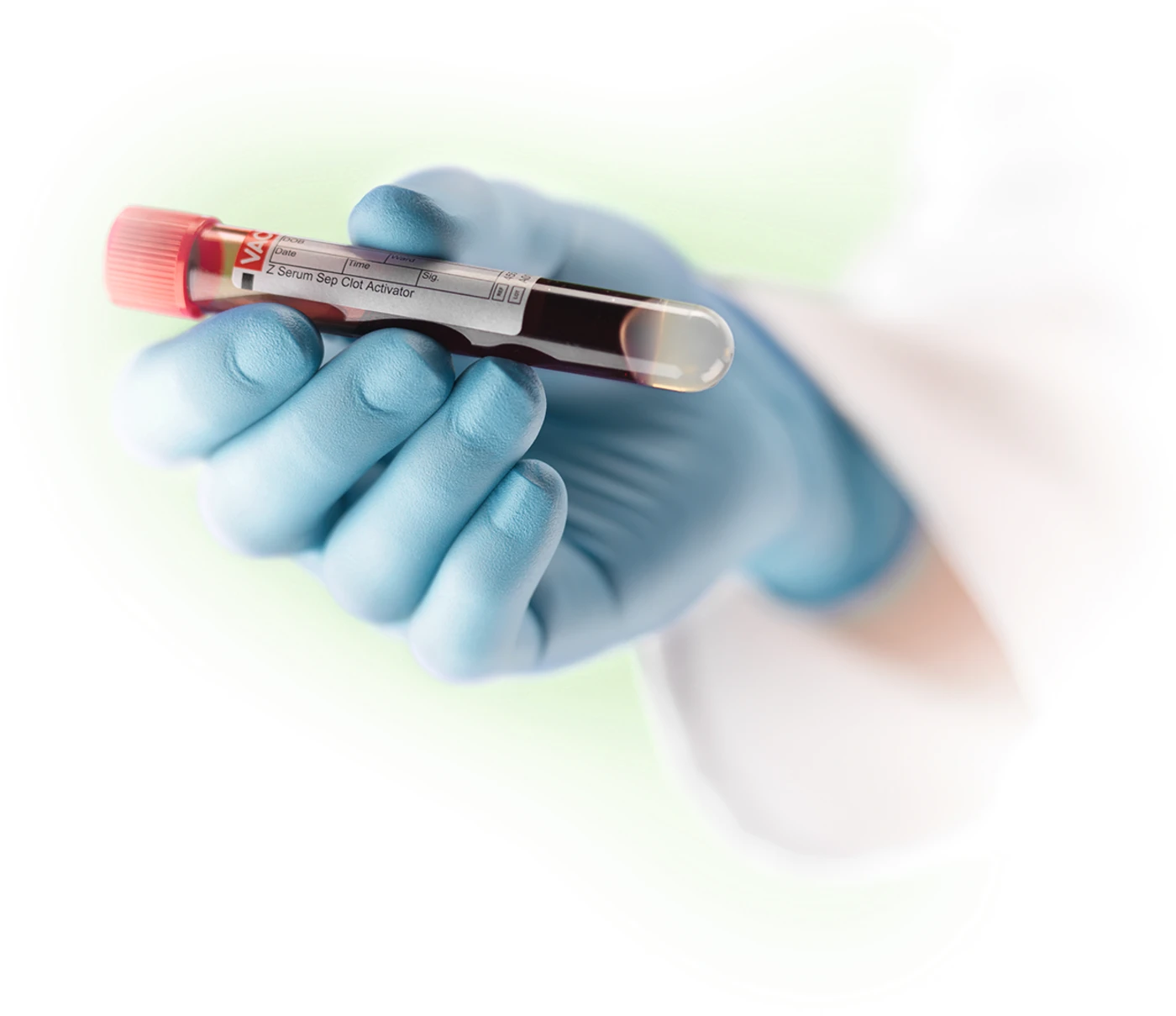 MICRO-TOUCH® Nitrax-Tex™ Packung 100 Stück puderfrei, blau, S