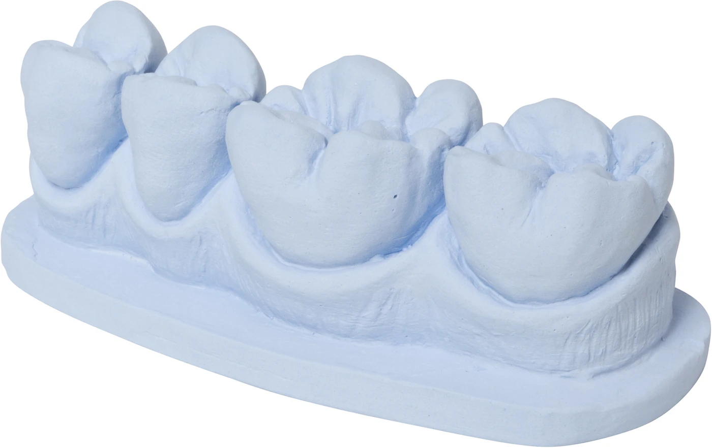 dento-dur® 110 Karton 25 kg blau, quick